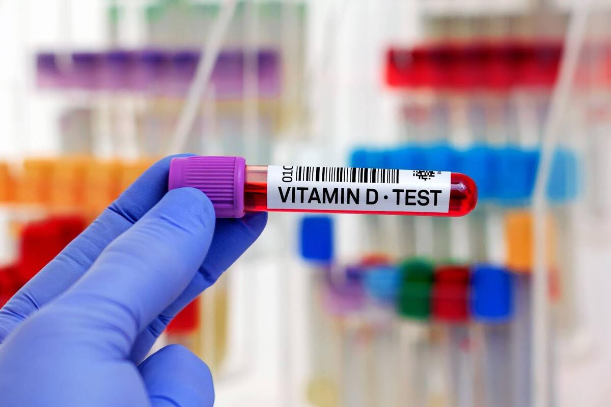 Monitoring Vitamin-D levels is critical for optimizing depression treatment