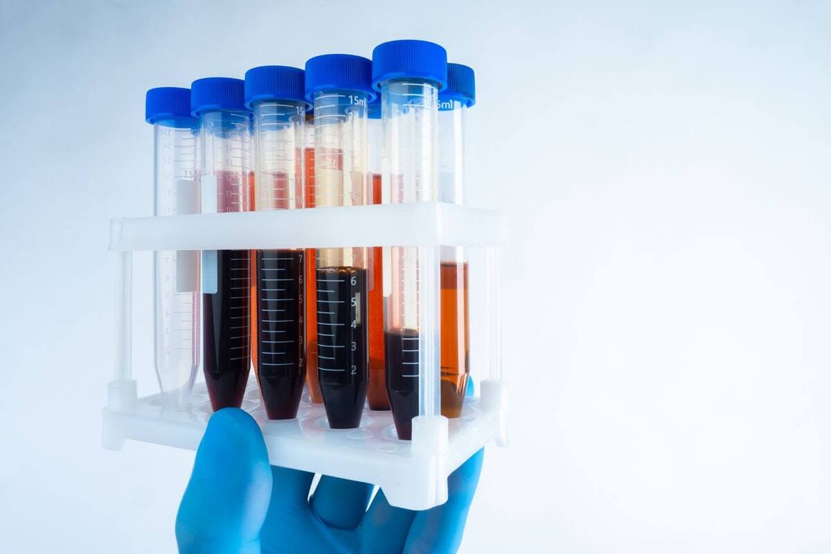 Comprehensive depression treatment may include receiving recurring bloodwork and incorporating supplements into your daily regimen to ensure you are reaching an optimal level of vitamin-D.